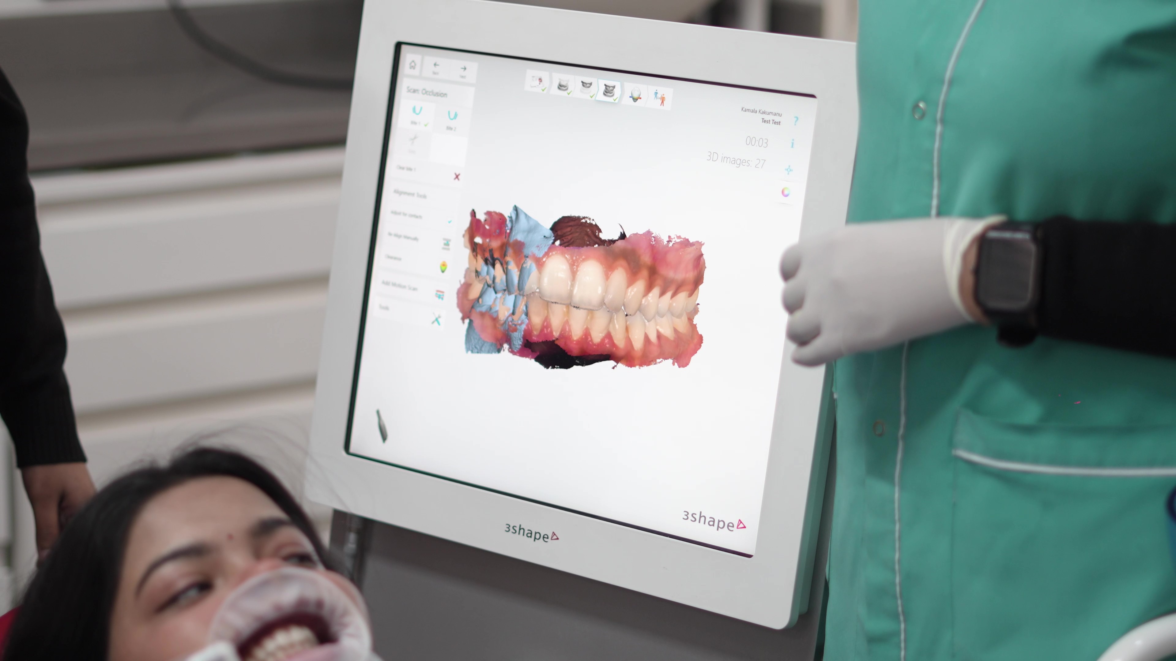 3D Intraoral Scanner